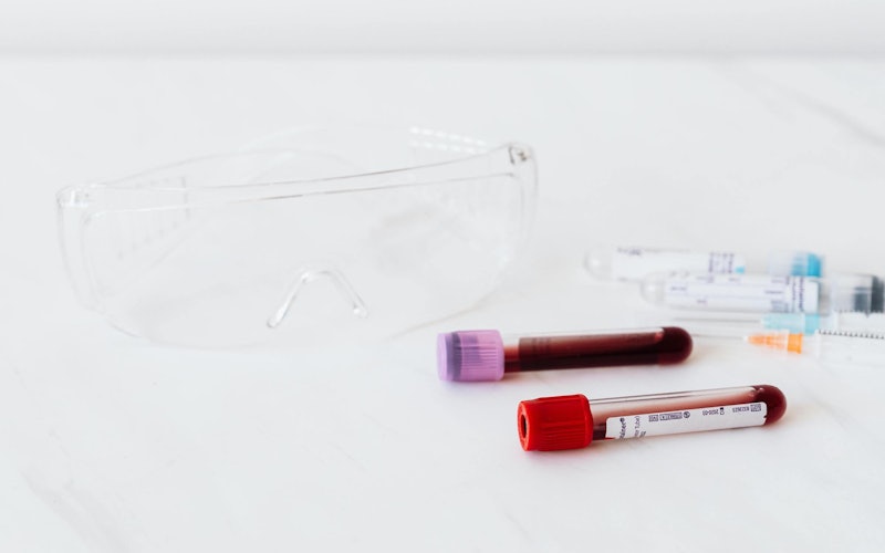 Blood samples and googles laying on a white table.